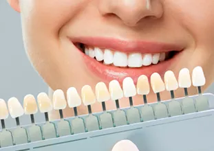 ホワイトニング