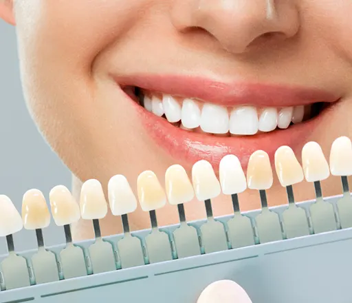 ホワイトニング